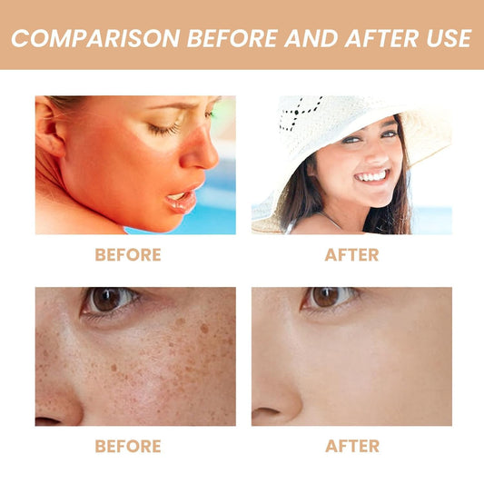 Korean Skin Care Solution for All Skin Types, S-P-F50 +PA++++, Sp50+++Korean Skin Care Solution for All Skin Types